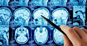 Minimalno invazivna neurohirurgija Minimalno invazivna neurohirurgija